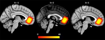 Anatomical and Neurochemical Correlates of Parental Verbal Abuse: A Combined MRS—Diffusion MRI Study
